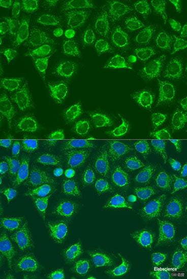 Western blot analysis of extracts of U-251MG cells using OTUD7A Polyclonal Antibody at dilution of 1:1000.