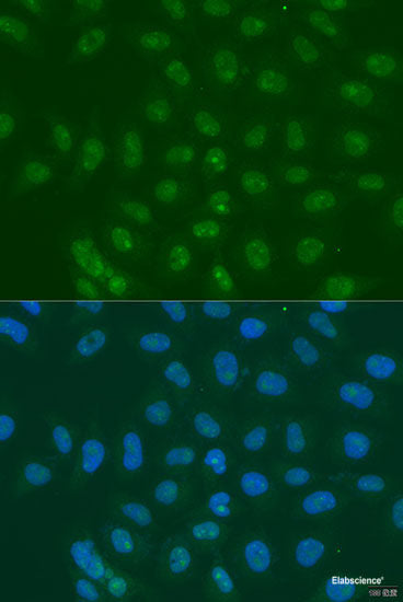 Western blot analysis of extracts of various cell lines using TIMP2 Polyclonal Antibody at dilution of 1:1000.