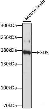 Immunohistochemistry of paraffin-embedded Human mammary cancer using LC3A / LC3B Polyclonal Antibody at dilution of 1:100 (40x lens).