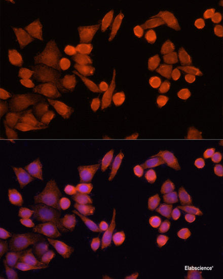 Immunohistochemistry of paraffin-embedded Rat testis using Twist Polyclonal Antibody at dilution of 1:100 (40x lens).