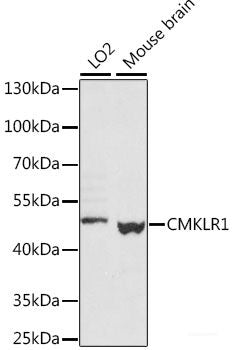 Immunofluorescence analysis of HeLa cells using CST3 Polyclonal Antibody