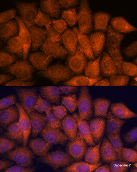 Immunohistochemistry of paraffin-embedded Rat kidney using ITCH Polyclonal Antibody at dilution of 1:50 (40x lens).