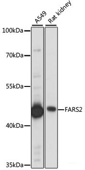 Western blot analysis of extracts of various cell lines using NTRK1 Polyclonal Antibody at dilution of 1:500.