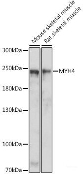 Western blot analysis of extracts of HepG2 cells using AGT Polyclonal Antibody at dilution of 1:1000.