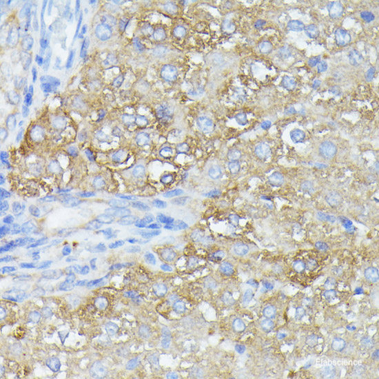Immunofluorescence analysis of U2OS cells using ALB Polyclonal Antibody at dilution of 1:100. Blue: DAPI for nuclear staining.