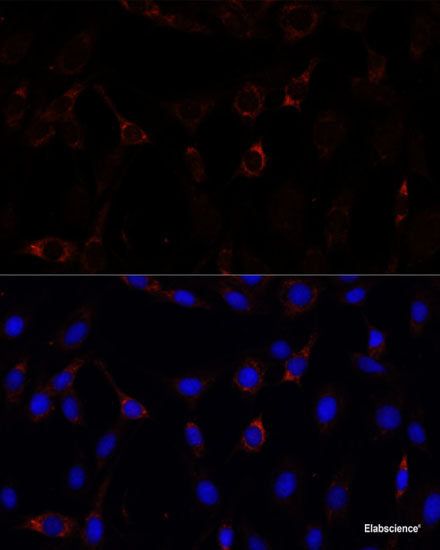 Western blot analysis of extracts of various cell lines using C1R Polyclonal Antibody at dilution of 1:1000.