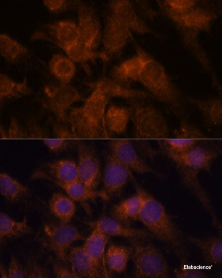 Western blot analysis of extracts of various cell lines using PLCG1 Polyclonal Antibody at dilution of 1:1000.