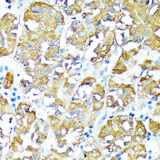 Immunohistochemistry of paraffin-embedded Rat brain using PPP2R5D Polyclonal Antibody at dilution of 1:100 (40x lens).