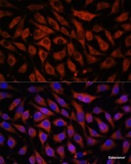 Immunohistochemistry of paraffin-embedded Rat liver using HP Polyclonal Antibody at dilution of 1:100 (40x lens).