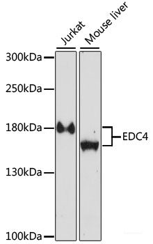Immunofluorescence analysis of U2OS cells using SAFB Polyclonal Antibody at dilution of 1:100. Blue: DAPI for nuclear staining.