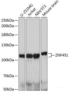 Immunofluorescence analysis of U2OS cells using AURKA Polyclonal Antibody at dilution of 1:100. Blue: DAPI for nuclear staining.