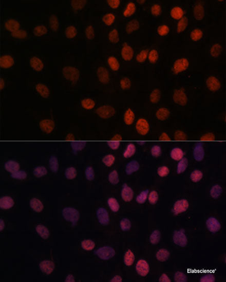 Western blot analysis of extracts of various cell lines using RBM39 Polyclonal Antibody at dilution of 1:1000.