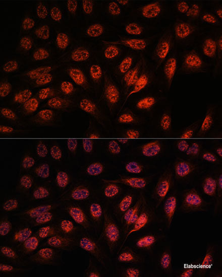 Immunofluorescence analysis of C6 cells using GOLGA5 Polyclonal Antibody at dilution of 1:100. Blue: DAPI for nuclear staining.