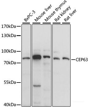 Western blot analysis of extracts of various cell lines using CD2BP2 Polyclonal Antibody at dilution of 1:1000.