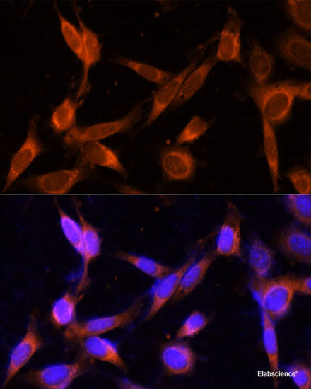 Immunofluorescence analysis of C6 cells using ACAA2 Polyclonal Antibody at dilution of 1:100. Blue: DAPI for nuclear staining.