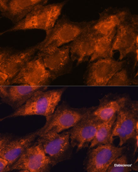 Immunofluorescence analysis of Rat bone marrow using CD11B Polyclonal Antibody at dilution of 1:100. Blue: DAPI for nuclear staining.