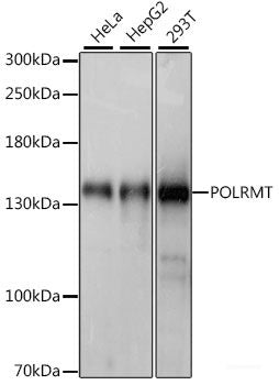 Immunohistochemistry of paraffin-embedded Rat brain using TIMM8B Polyclonal Antibody at dilution of 1:100 (40x lens).
