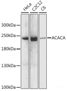 Immunohistochemistry of paraffin-embedded Rat brain using COPG2 Polyclonal Antibody at dilution of 1:100 (40x lens).