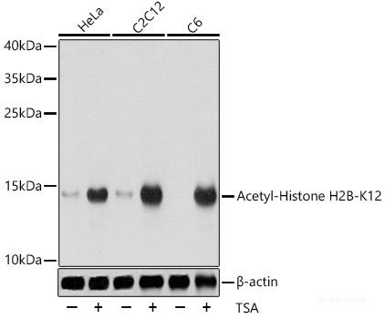 Western blot analysis of extracts of U-251MG cells using PACSIN1 Polyclonal Antibody at dilution of 1:1000.