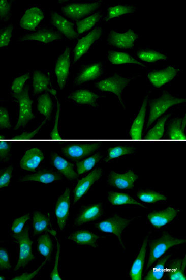 Immunofluorescence analysis of NIH-3T3 cells using PIK3R4 Polyclonal Antibody at dilution of 1:100 (40x lens). Blue: DAPI for nuclear staining.