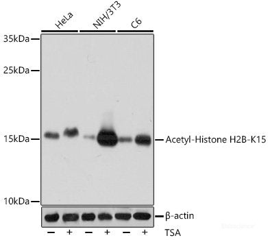 Western blot analysis of extracts of Rat pancreas using ASCC1 Polyclonal Antibody at dilution of 1:1000.