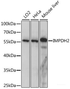 Western blot analysis of extracts of Rat ovary using SCARB1 Polyclonal Antibody at dilution of 1:1000.