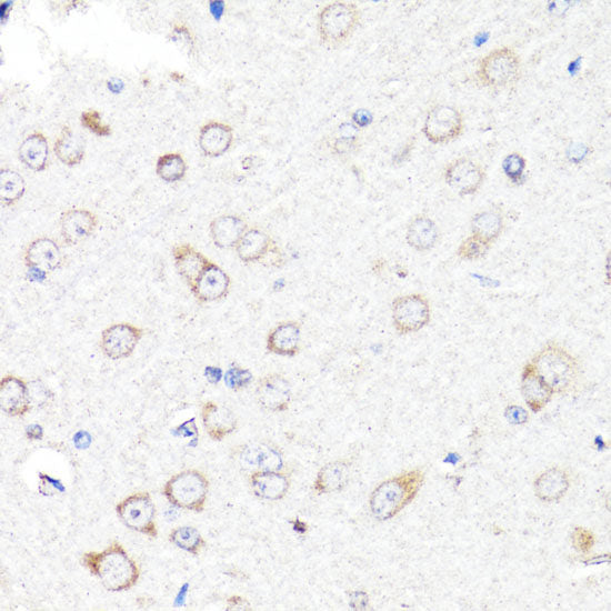 Immunofluorescence analysis of C6 cells using UBE2J1 Polyclonal Antibody at dilution of 1:100. Blue: DAPI for nuclear staining.