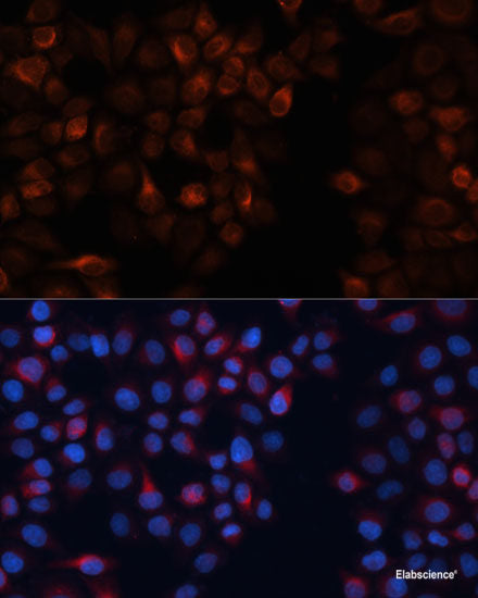 Western blot analysis of extracts of Rat lung using TPCN1 Polyclonal Antibody at dilution of 1:1000.