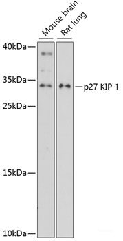 Western blot analysis of extracts of various cell lines using OXSM Polyclonal Antibody at dilution of 1:1000.
