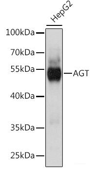 Western blot analysis of extracts of various cell lines using TRIM62 Polyclonal Antibody at dilution of 1:1000.