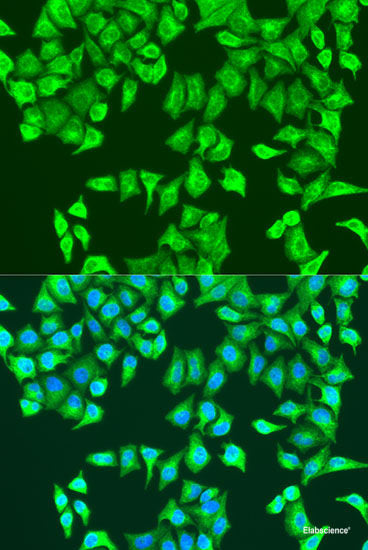 Immunofluorescence analysis of C6 cells using CCDC47 Polyclonal Antibody at dilution of 1:100. Blue: DAPI for nuclear staining.