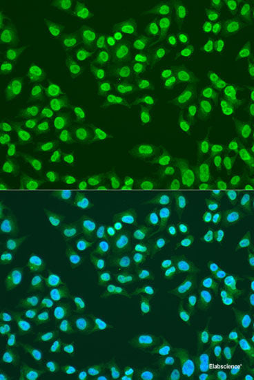 Immunofluorescence analysis of U-2 OS cells using WDR18 Polyclonal Antibody at dilution of 1:100. Blue: DAPI for nuclear staining.