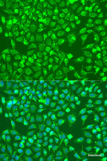 Immunohistochemistry of paraffin-embedded Rat brain using CHRNA7 Polyclonal Antibody at dilution of 1:100 (40x lens).
