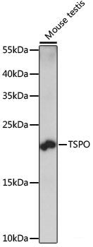 Immunofluorescence analysis of HeLa cells using KIF13A Polyclonal Antibody at dilution of 1:100. Blue: DAPI for nuclear staining.