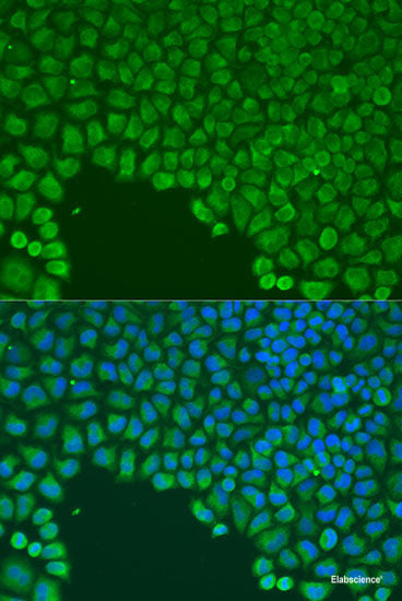 Western blot analysis of extracts of various cell lines using MYOC Polyclonal Antibody at dilution of 1:1000.