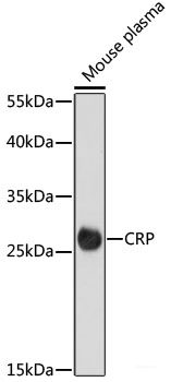Immunofluorescence analysis of C6 cells using CEP85 Polyclonal Antibody at dilution of 1:100. Blue: DAPI for nuclear staining.