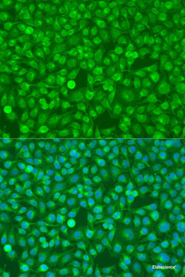 Immunofluorescence analysis of C6 cells using UPF3A Polyclonal Antibody at dilution of 1:100. Blue: DAPI for nuclear staining.