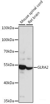 Immunofluorescence analysis of C6 cells using B3GNT4 Polyclonal Antibody at dilution of 1:100. Blue: DAPI for nuclear staining.
