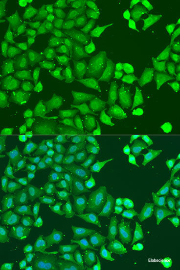 Western blot analysis of extracts of various cell lines using CYB5B Polyclonal Antibody at dilution of 1:1000.