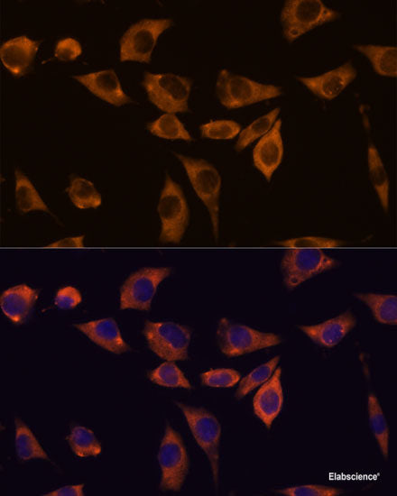 Western blot analysis of extracts of A375 cells using TRIM4 Polyclonal Antibody at dilution of 1:1000.
