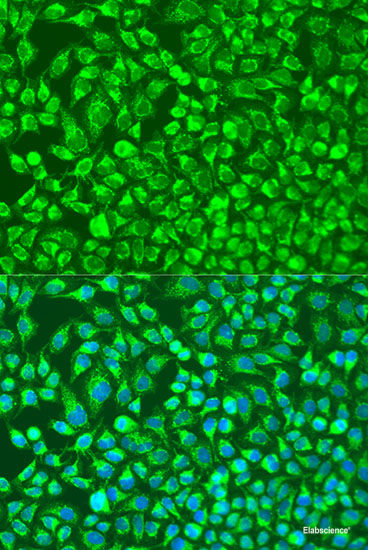 Immunofluorescence analysis of Rat testis using FER1L5 Polyclonal Antibody at dilution of 1:100. Blue: DAPI for nuclear staining.