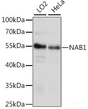 Immunohistochemistry of paraffin-embedded Rat kidney using BAD Polyclonal Antibody at dilution of 1:200 (40x lens).