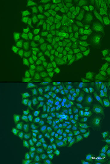 Western blot analysis of extracts of Rat pancreas using MVB12A Polyclonal Antibody at dilution of 1:1000.