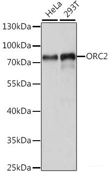 Western blot analysis of extracts of various cell lines using RBP7 Polyclonal Antibody at dilution of 1:1000.