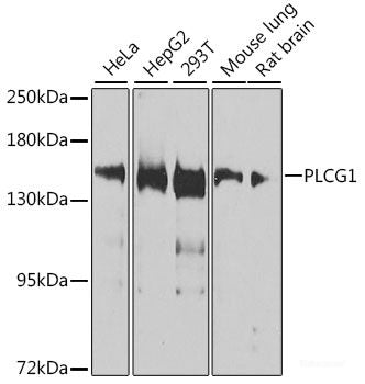 Western blot analysis of extracts of Rat eye using ZFYVE27 Polyclonal Antibody at dilution of 1:1000.