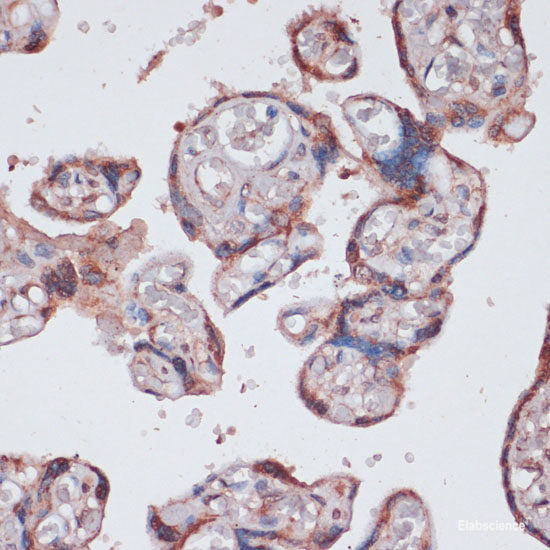 Immunofluorescence analysis of HeLa cells using N4-Methylcytidine Polyclonal Antibody at dilution of 1:100 (40x lens). Blue: DAPI for nuclear staining.