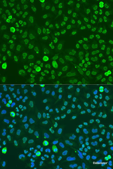 Western blot analysis of extracts of various cell lines using SULT1A1 Polyclonal Antibody at dilution of 1:1000.