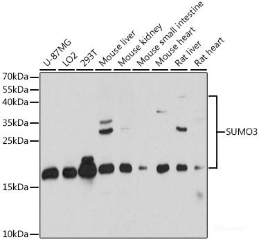 Western blot analysis of extracts of various cell lines using SLC14A1 Polyclonal Antibody at dilution of 1:1000.