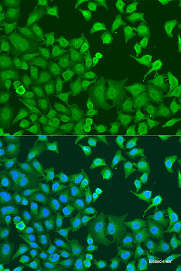 Western blot analysis of extracts of Jurkat cells using CENPA Polyclonal Antibody at dilution of 1:1000.