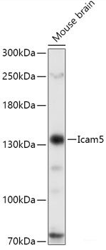 Immunofluorescence analysis of C6 cells using TSC2 Polyclonal Antibody at dilution of 1:100. Blue: DAPI for nuclear staining.